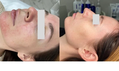 Уход Anti-Age "Defense" от  PHYTO-C